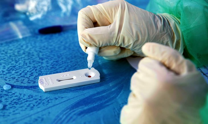 Moçambique, regista 36 infectados pela COVID-19 em 24h, Sem recuperados e dois óbitos